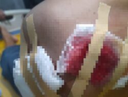 Jagad maya viral : Oknum Kiai Pamekasan Dilaporkan ke Polisi Usai Diduga Bacok Korban dengan Celurit