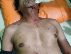 Seorang Pria di Prigen Nekat Berondong Warga dengan Airsoft Gun