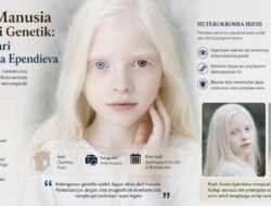 Pigmen Manusia dan Variasi Genetik: Pelajaran dari Sosok Amina Ependieva