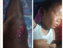 Diduga Asal-Asalan, Proyek Tambal Sulam Jalan Kwanyar-Modung Memakan Korban